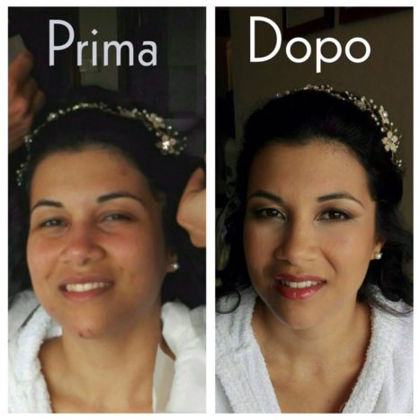 PRIMA&DOPO